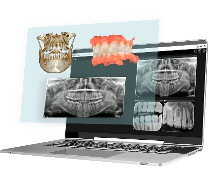 Dental X-Ray Machine