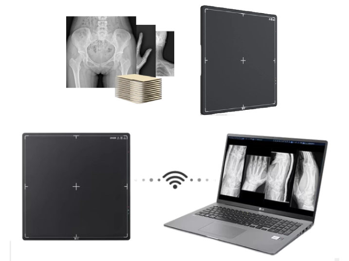 X-ray chiropractic install