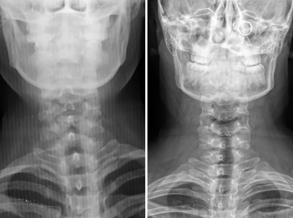 x-ray image quality