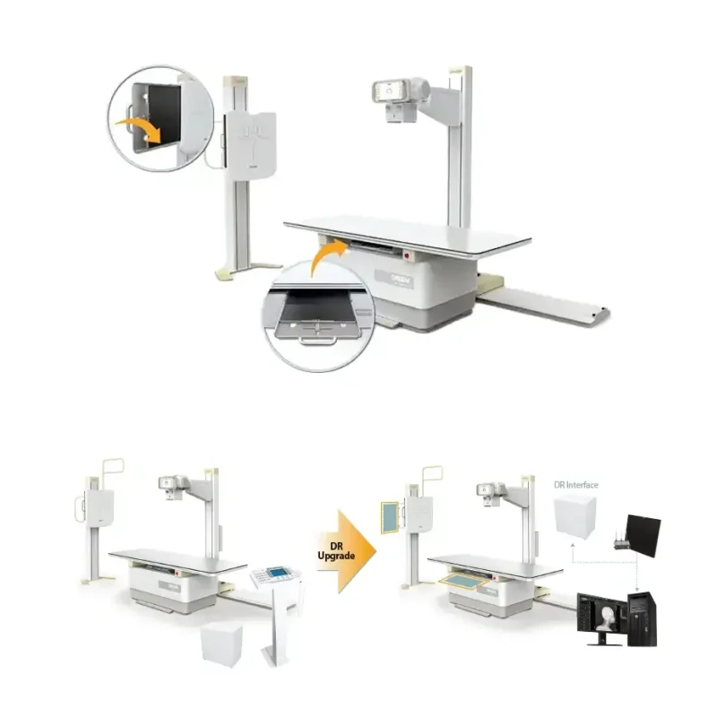 DRGEM retrofit DR upgrade