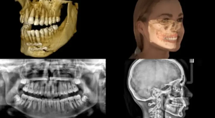 CS 9600 CBCT Scanner