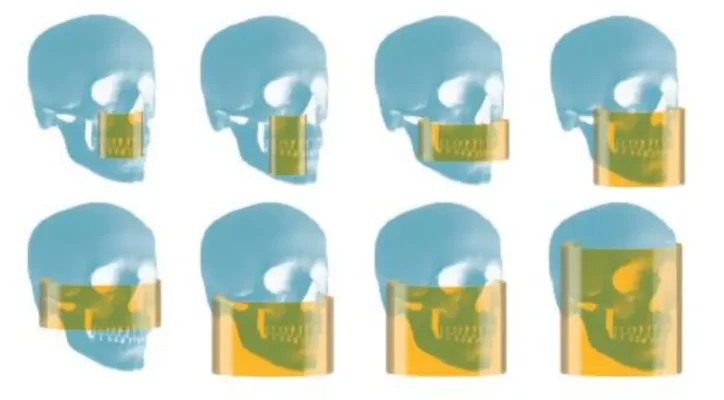 CS 9600 CBCT Scanner