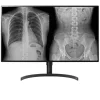 LG 332HL512D Medical Diagnostic Monitor Display