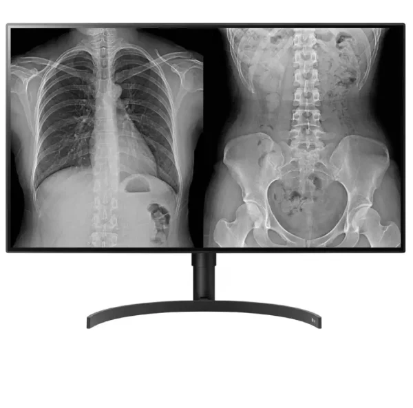 LG 332HL512D Medical Monitor Display